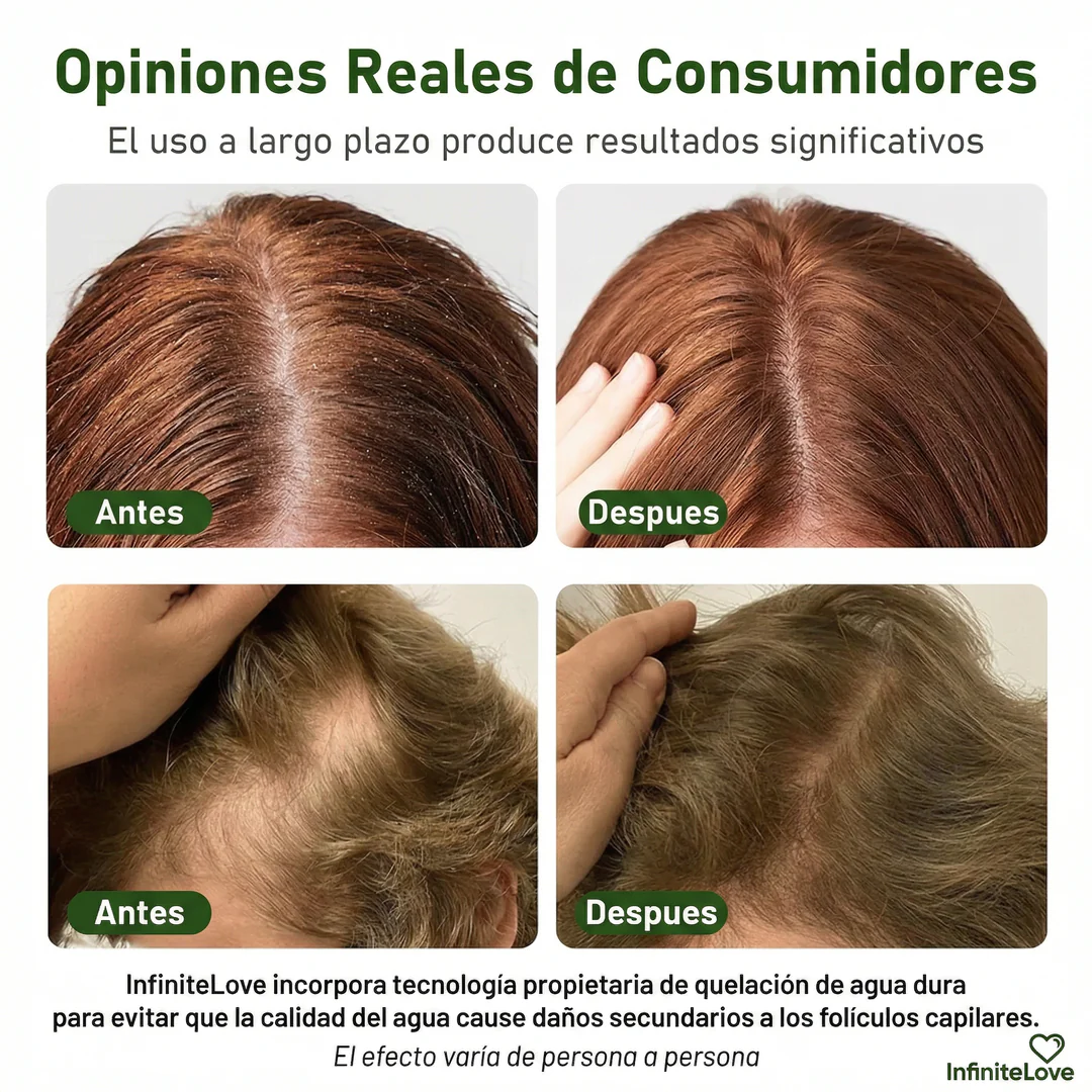 Champú Sólido Anticaída – Fortalece Raíces y Reduce la Caída del Cabello - Image 3