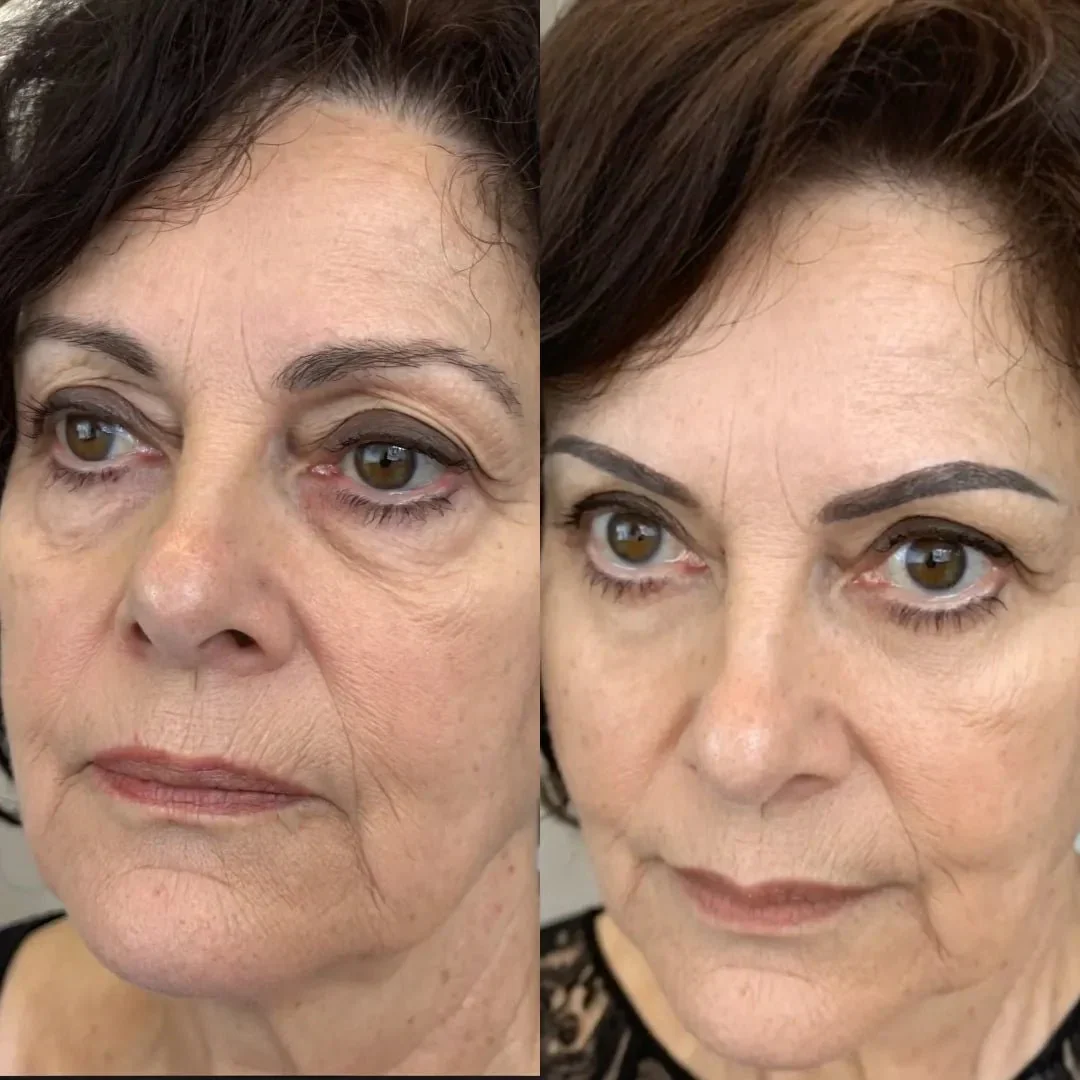 RevitaOjos - Dispositivo Antiedad de Luz Roja y EMS para Eliminar Bolsas, Ojeras y Hinchazón - Image 5
