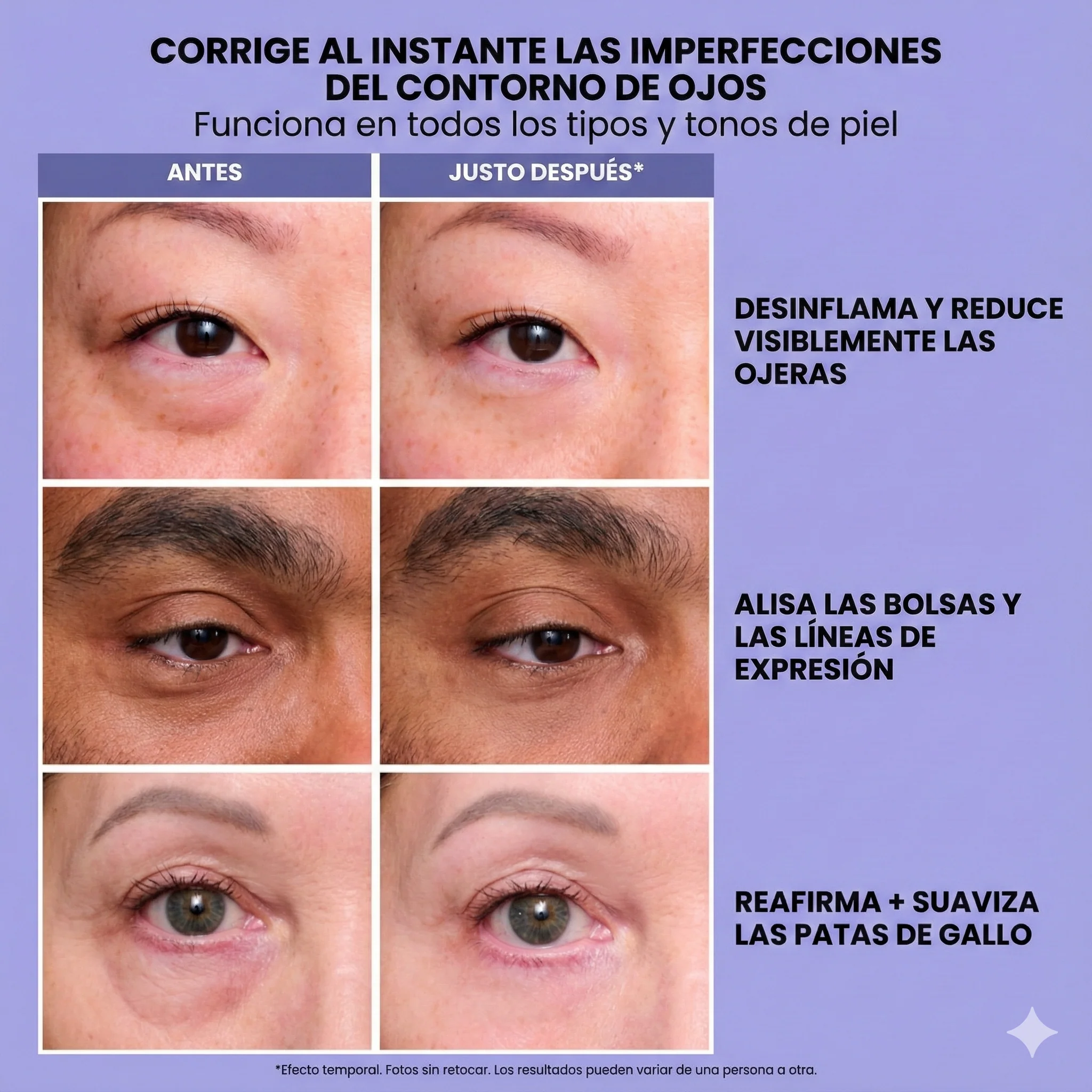 Gel Reafirmante Intensivo para Contorno de Ojos - Image 5