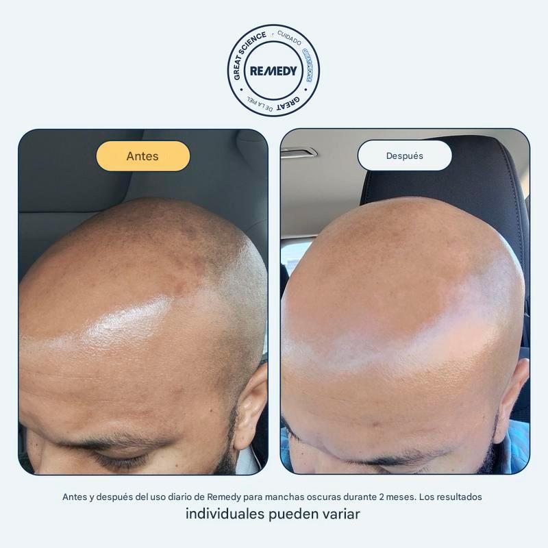 Sérum puntos negros - Image 3