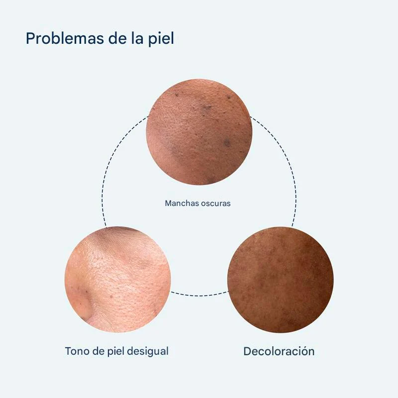 Sérum puntos negros - Image 4