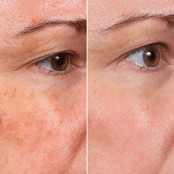 Suero Facial Rejuvenecedor - Image 5