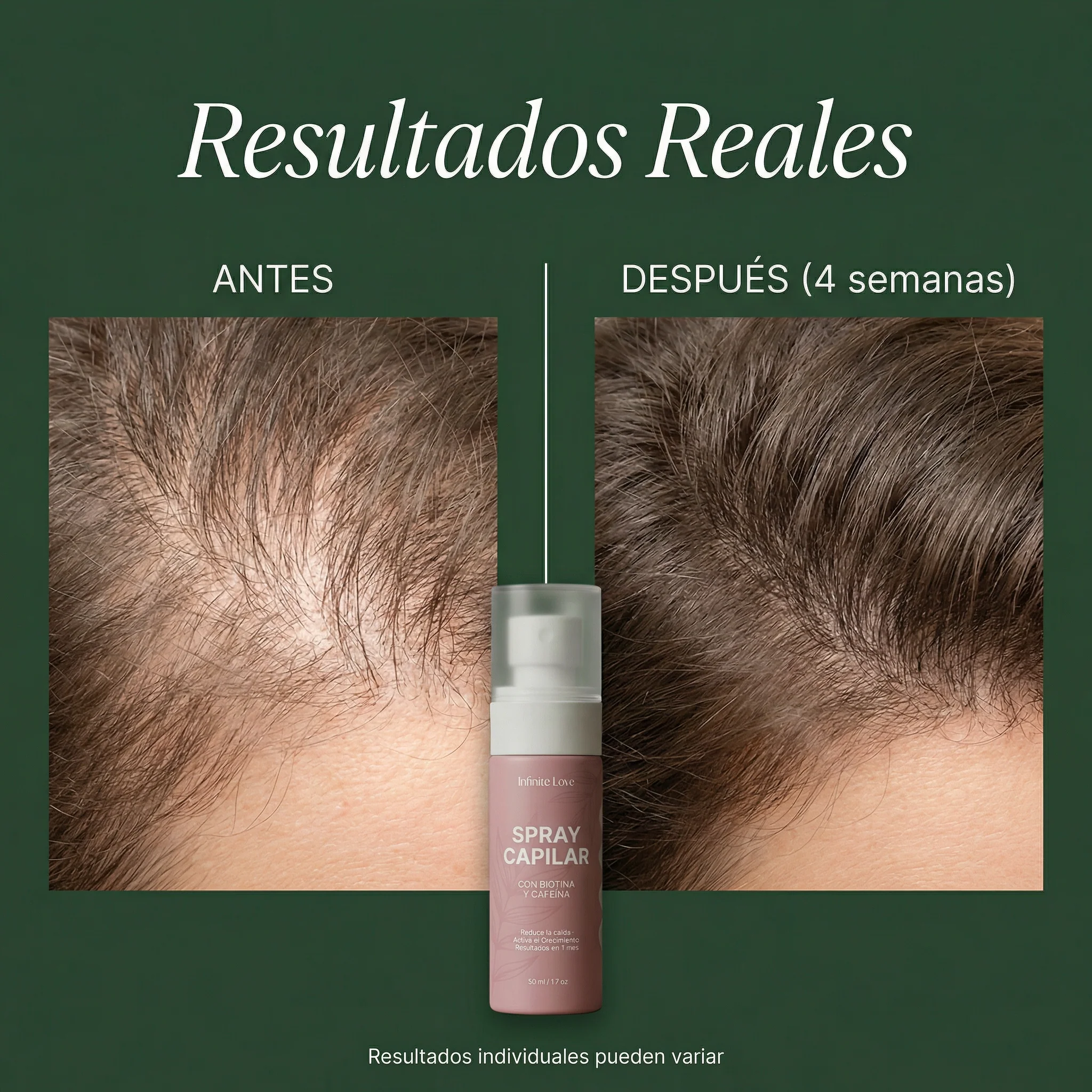 Spray Capilar Anticaída con Biotina y Cafeína – Fortalece y Reduce la Caída - Image 2